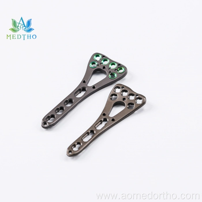 volar distal radius plate
